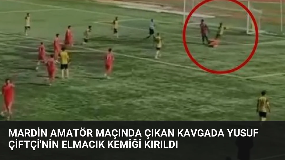 Mardin Amatör Maçında Çıkan Kavgada Yusuf Çiftçi’nin Elmacık Kemiği Kırıldı