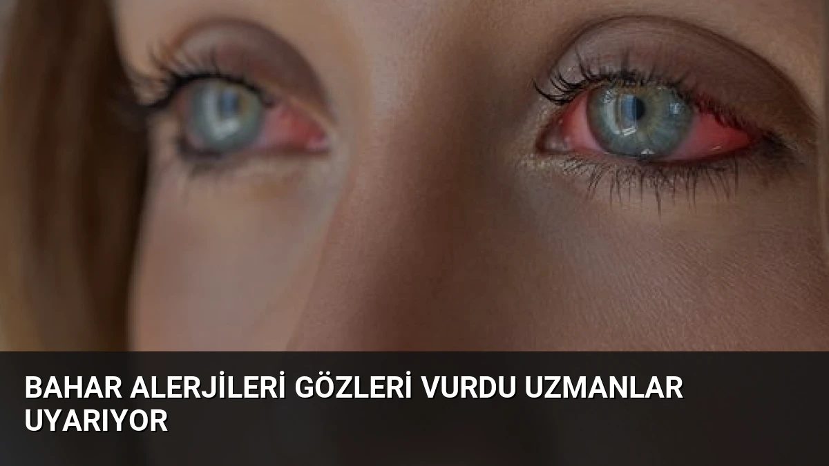 Bahar Alerjileri Gözleri Vurdu Uzmanlar Uyarıyor