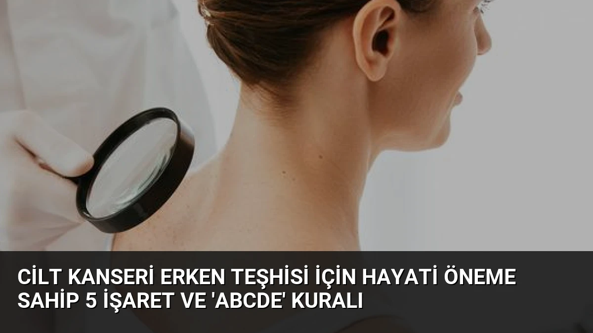 Cilt Kanseri Erken Teşhisi İçin Hayati Öneme Sahip 5 İşaret ve ‘ABCDE’ Kuralı