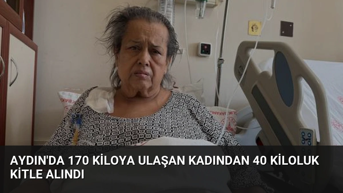 Aydın’da 170 Kiloya Ulaşan Kadından 40 Kiloluk Kitle Alındı