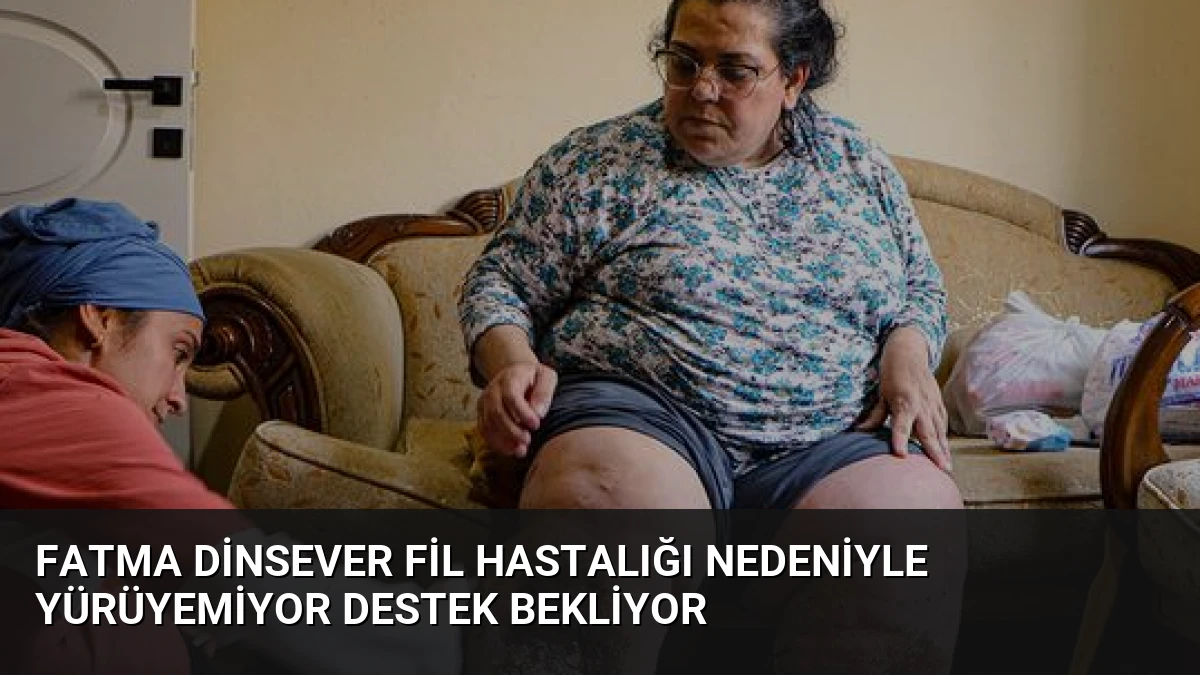 Fatma Dinsever Fil Hastalığı Nedeniyle Yürüyemiyor Destek Bekliyor