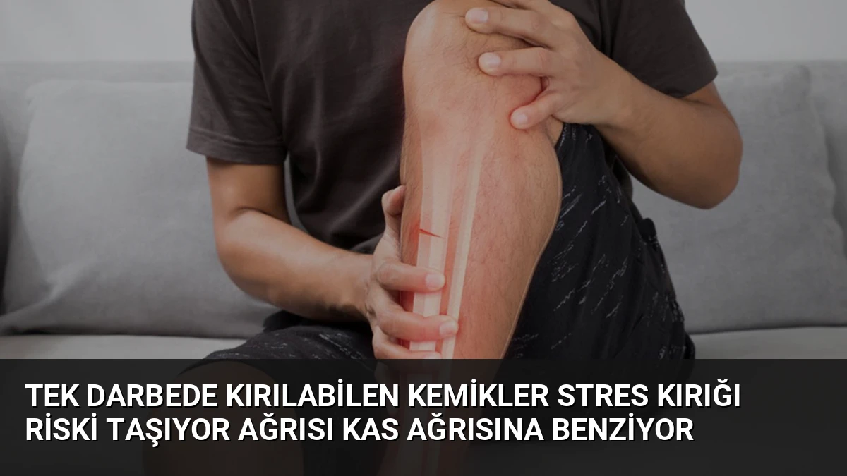 Tek Darbede Kırılabilen Kemikler Stres Kırığı Riski Taşıyor Ağrısı Kas Ağrısına Benziyor