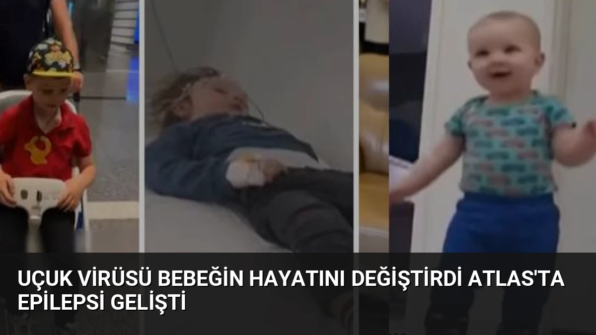 Uçuk Virüsü Bebeğin Hayatını Değiştirdi Atlas’ta Epilepsi Gelişti